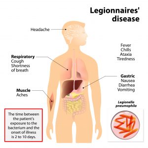 Legionnaires’disease
