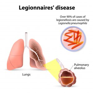 Legionnaires' Disease